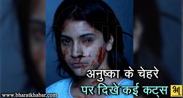 anushka 1 शादी के बाद अनुष्का ने शेयर की अपनी तस्वीर, चेहरे पर हैं खून और कट के निशान.....